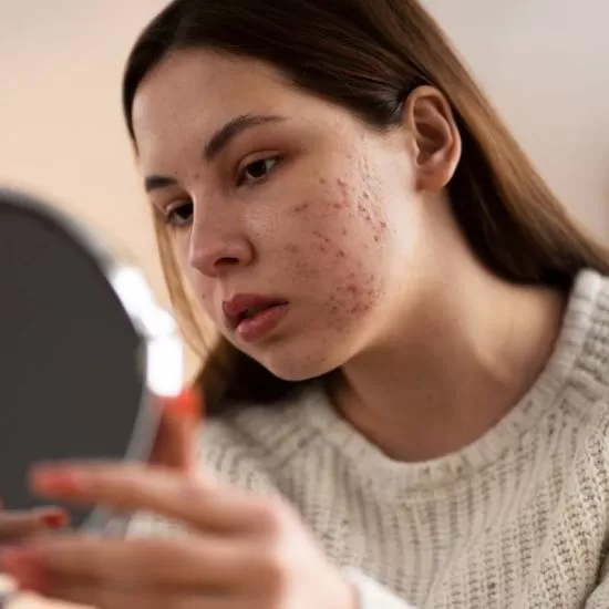 Herpes simplex virus treatment consultation at Signature Skin Jaipur