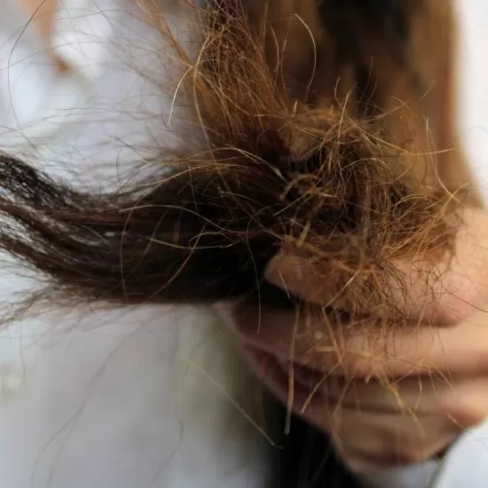 Hirsutism and unwanted hair treatment consultation at Signature Skin Jaipur