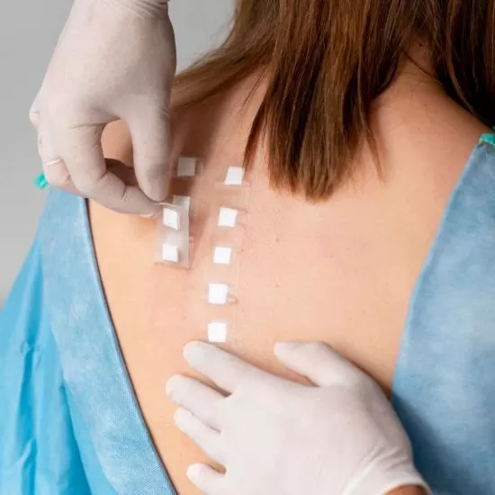 Patch test for skin allergy at Signature Skin Jaipur