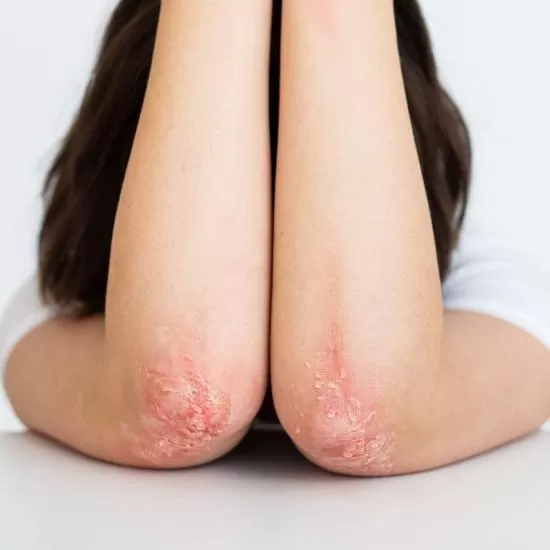 Giemsa stain diagnostic test at Signature Skin Jaipur