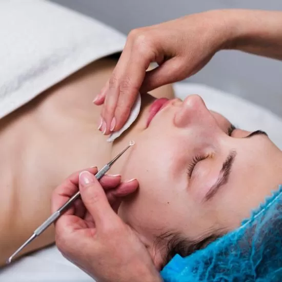 Comedone Extraction at Signature Skin Jaipur