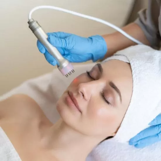 Microdermabrasion treatment at Signature Skin Jaipur