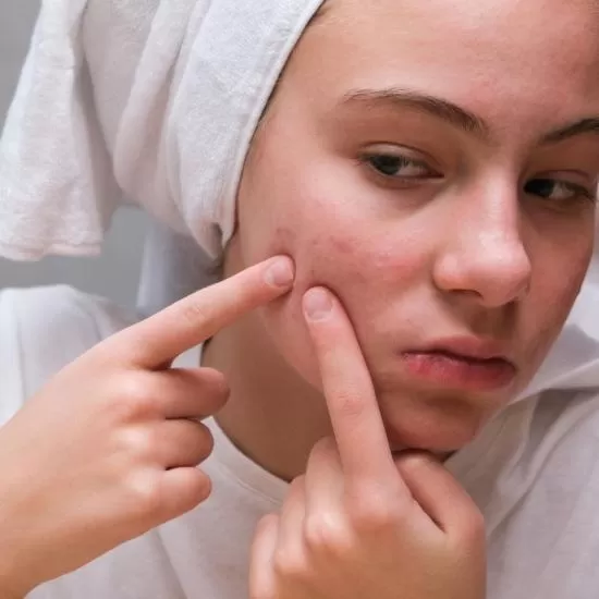 Rosacea Treatment at Signature Skin Jaipur